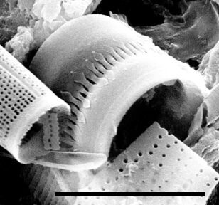 Aulacoseira pseudoamericana SEM