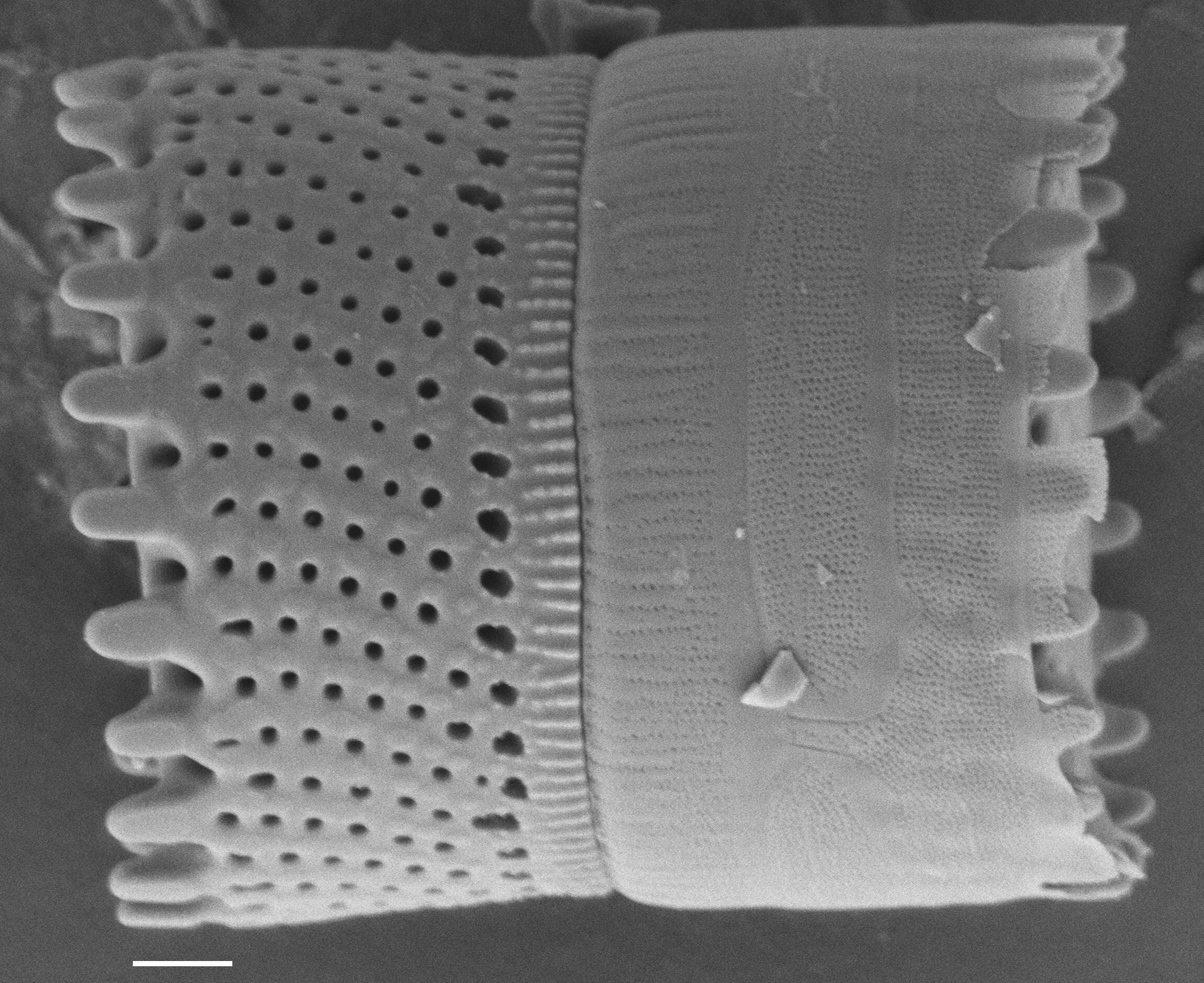 Aulacoseira scalaris SEM1