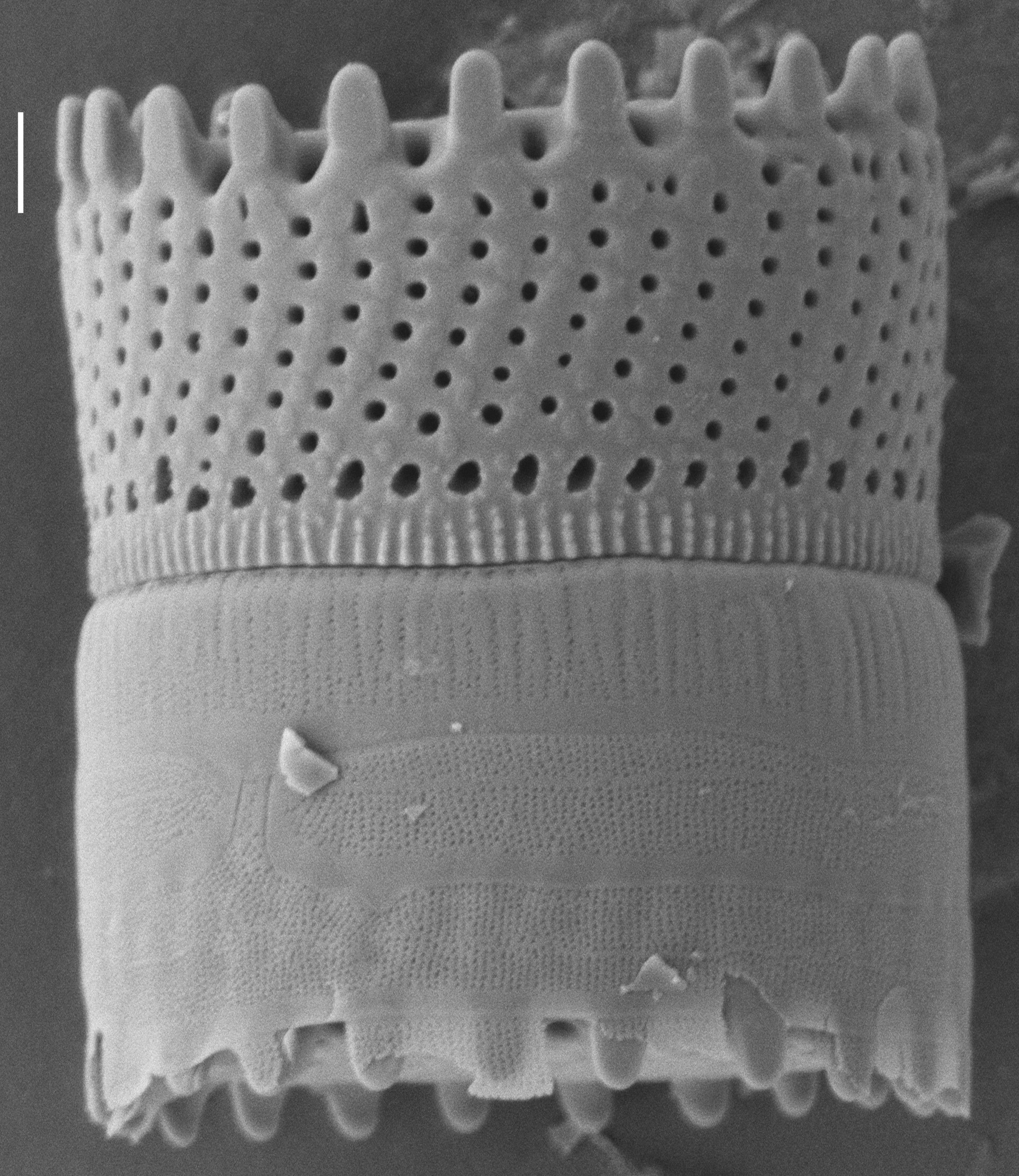 Aulacoseira scalaris SEM1