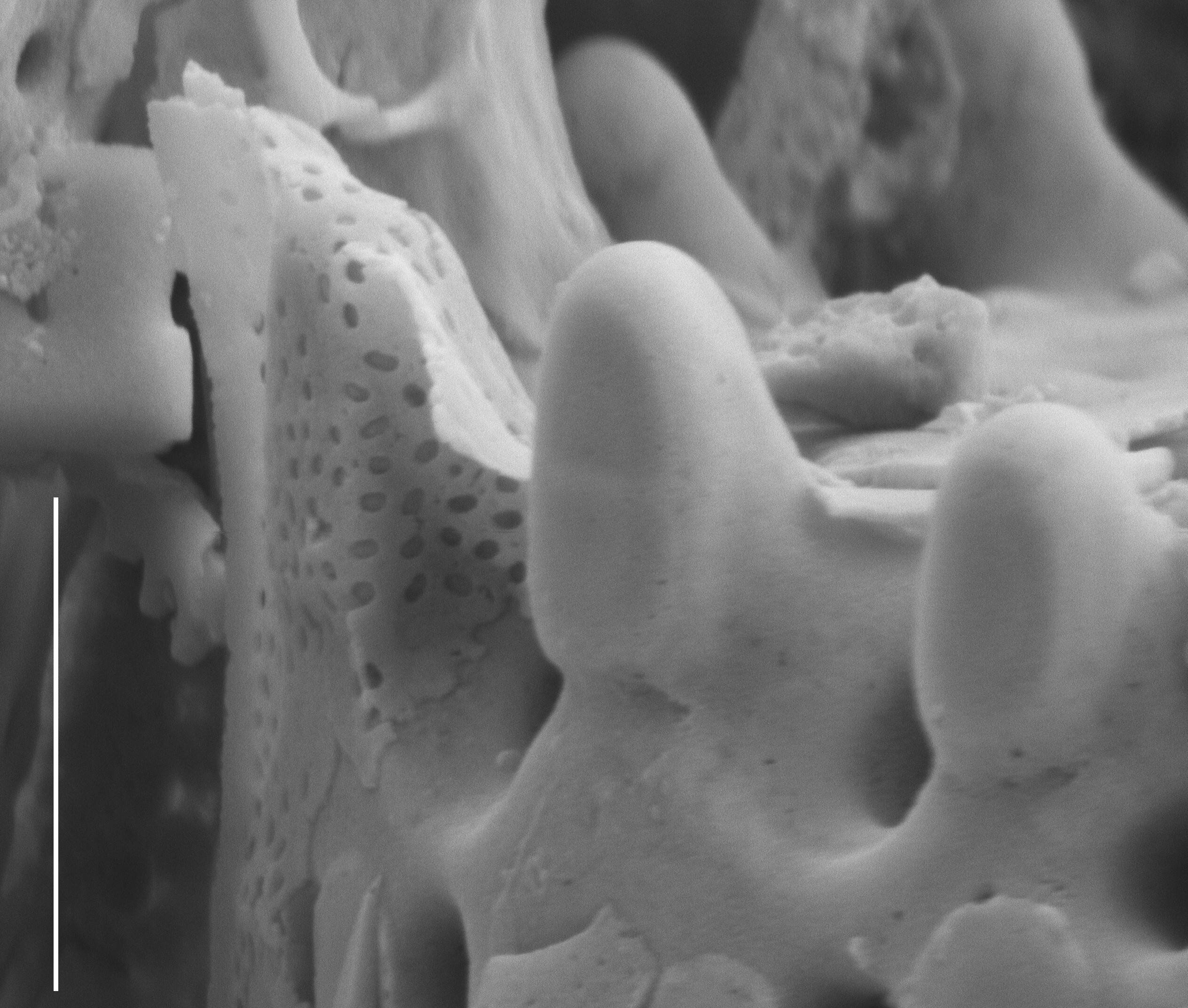 Aulacoseira scalaris SEM3