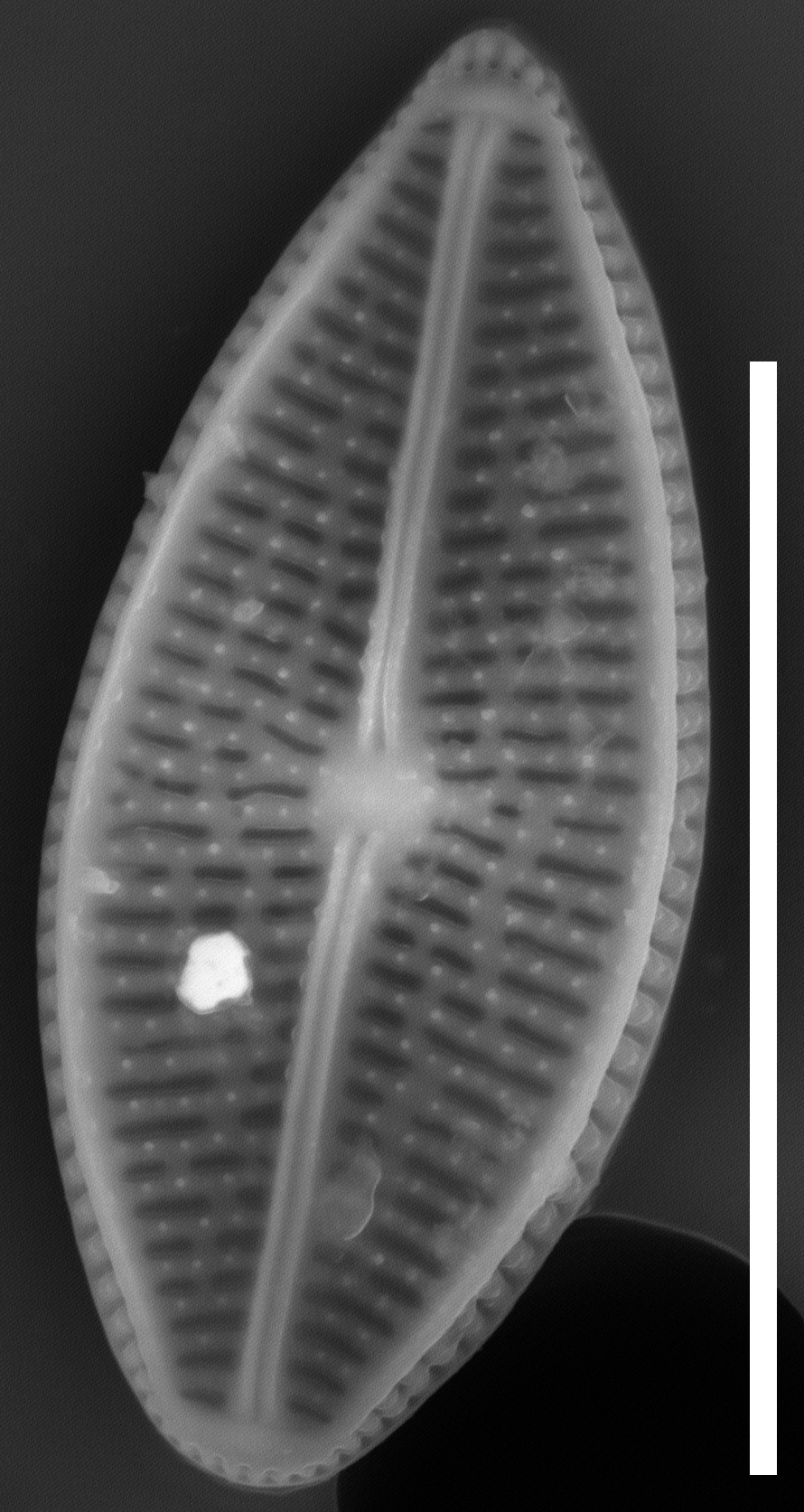 Brachysira chiaruccii SEM13 INSTAAR 17660