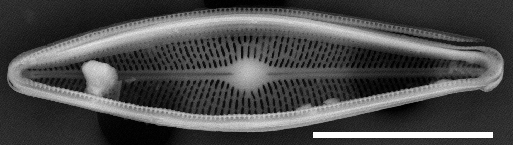 Brachysira chiaruccii SEM5 INSTAAR 17660