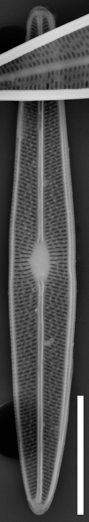 Brachysira chiarucii SEM4 INSTAAR 17660