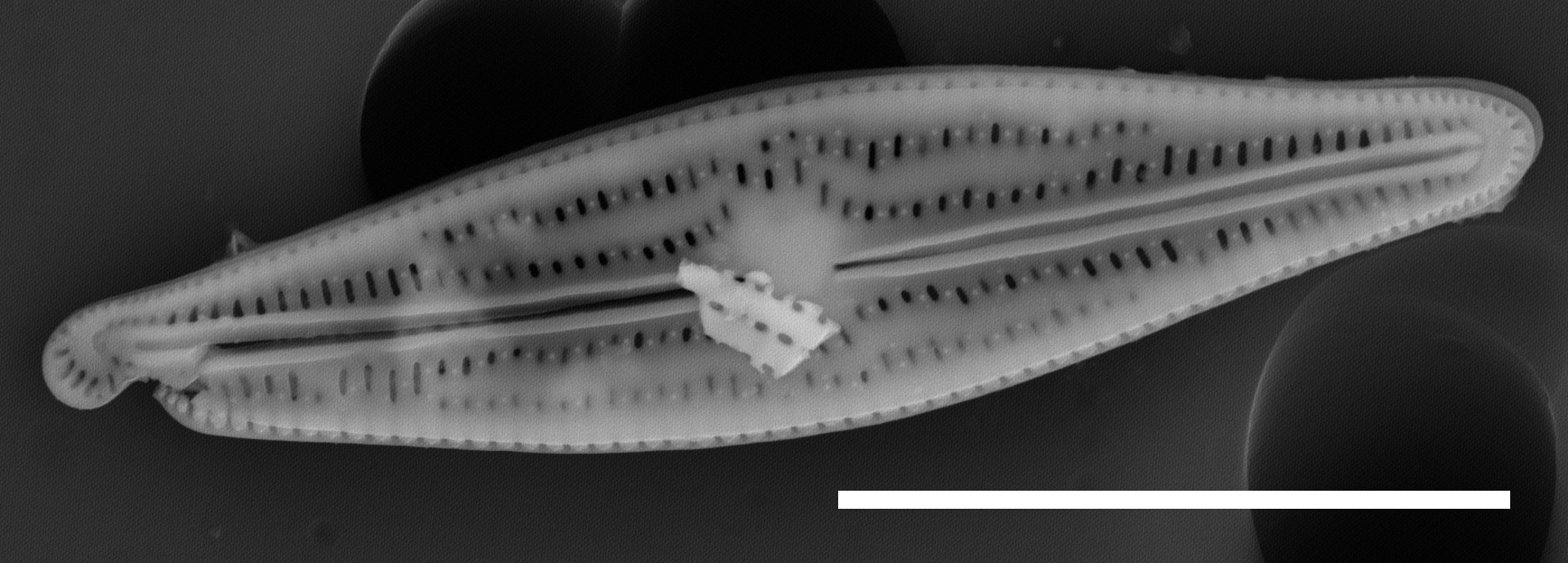Brachysira elisabethiana INSTAAR 17660