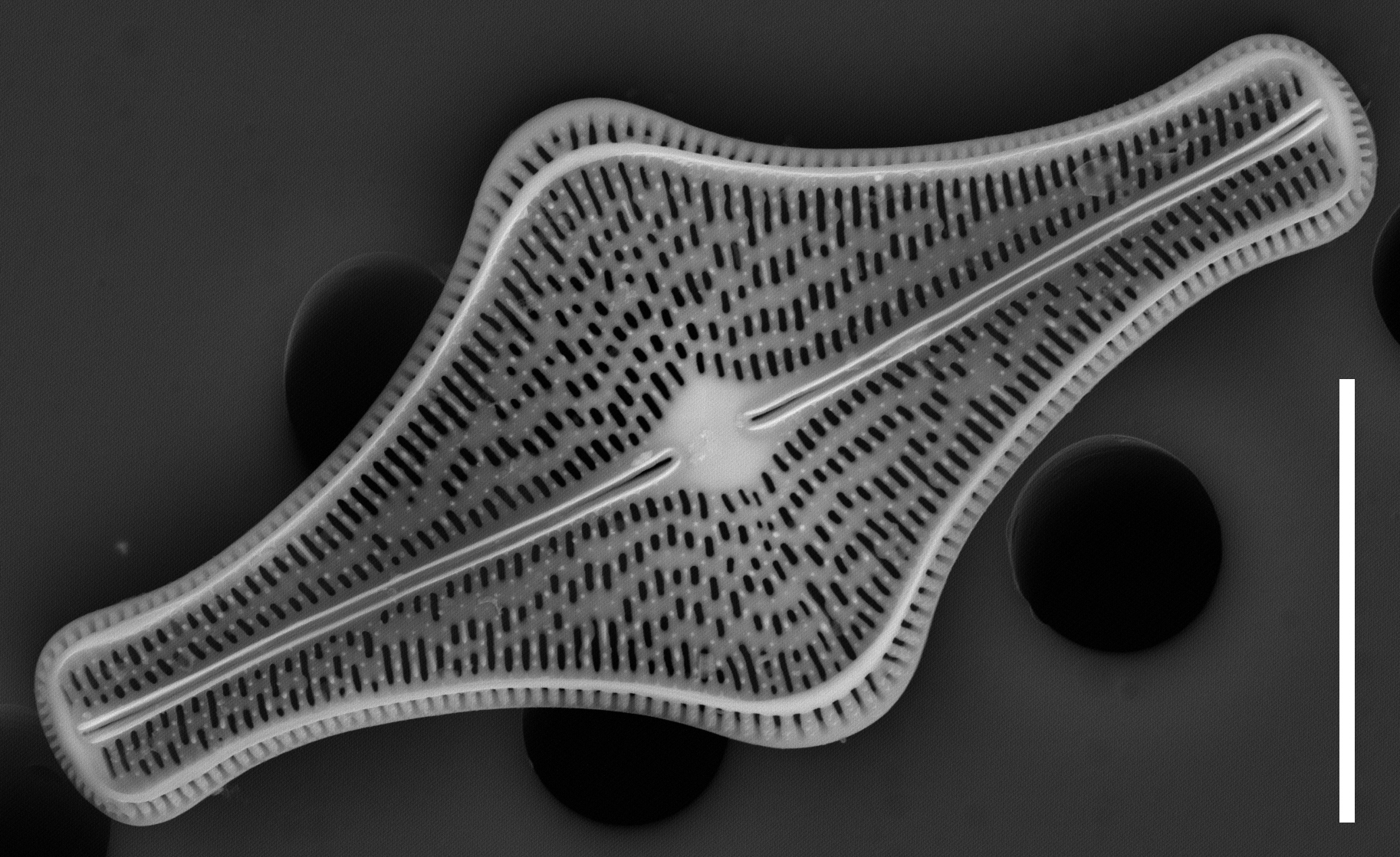 Brachysira follis SEM2