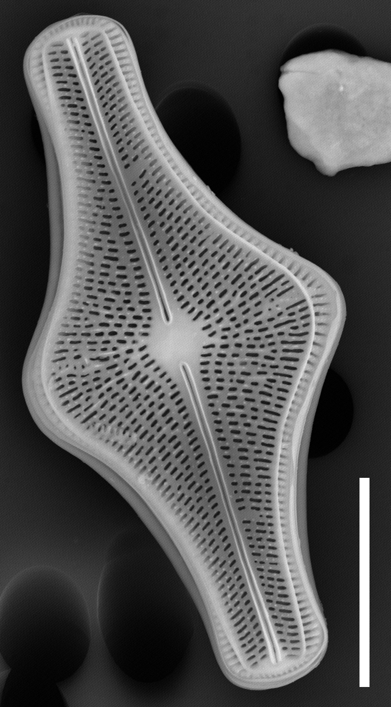 Brachysira follis SEM1