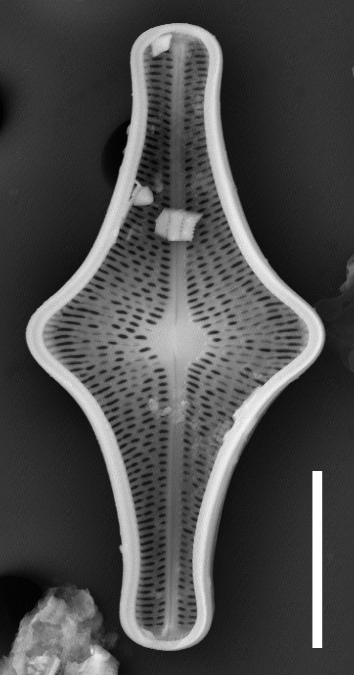 Brachysira follis SEM3