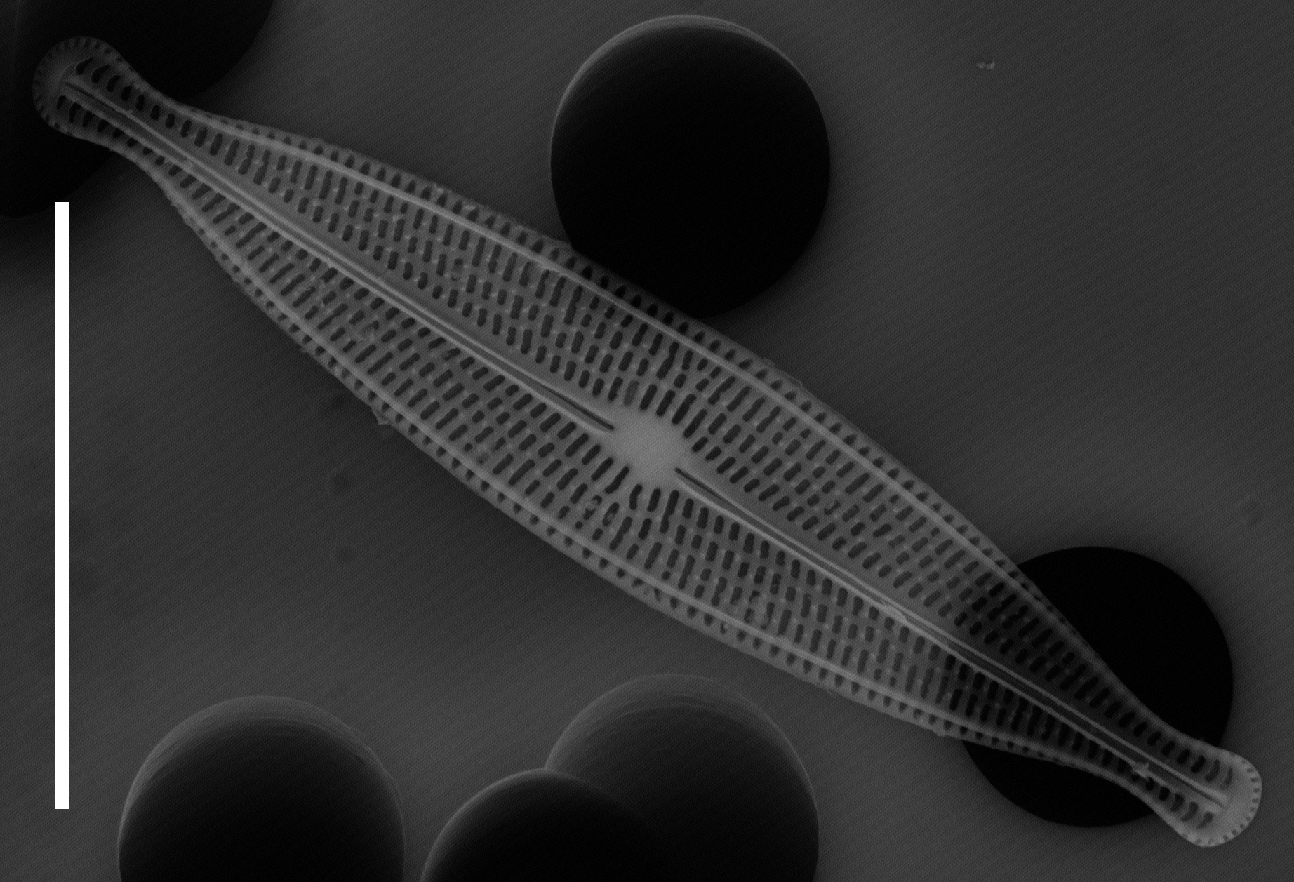 Brachysira neoexilis SEM1