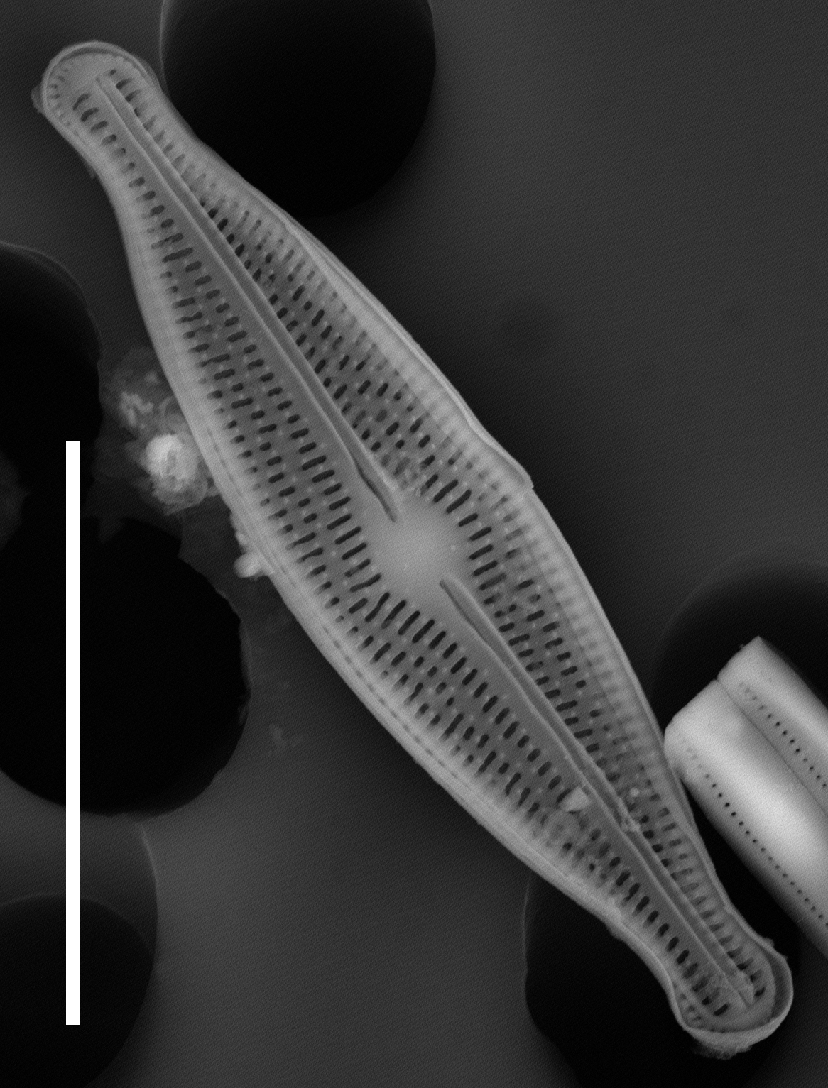 Brachysira neoexilis SEM2
