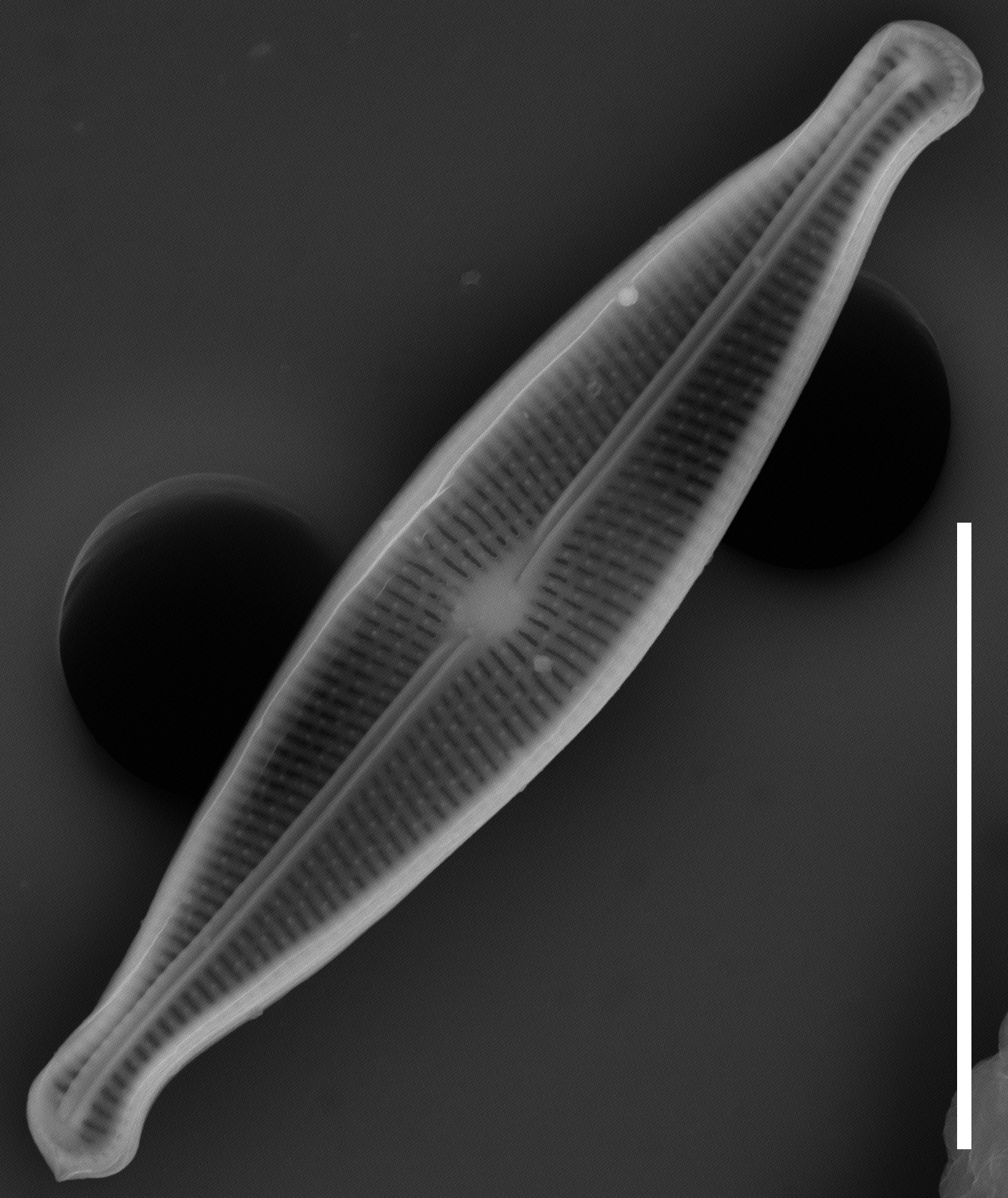 Brachysira neoexilis SEM3