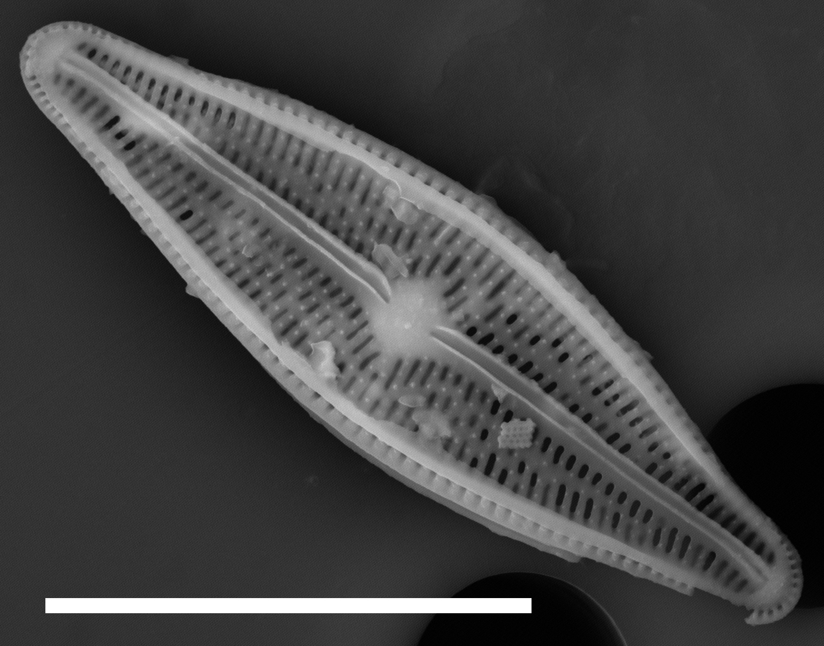 Brachysira sp 1 SEM1 INSTAAR 17658
