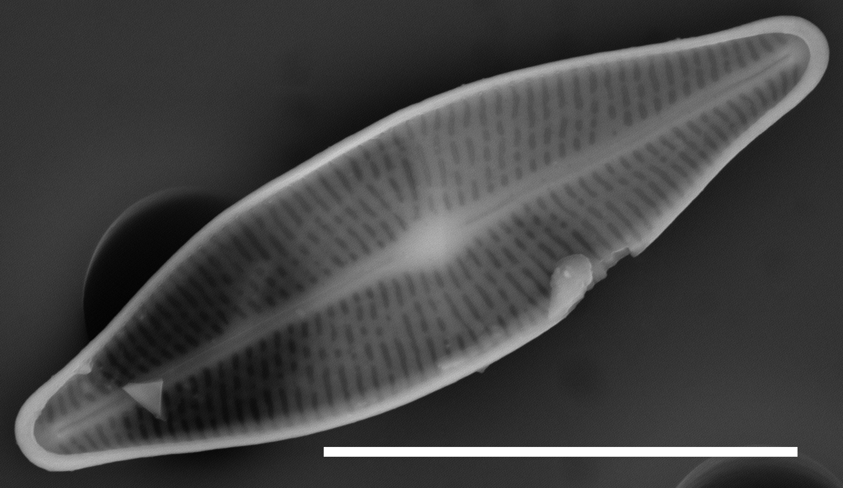 Brachysira sp 1 SEM2 INSTAAR 17660