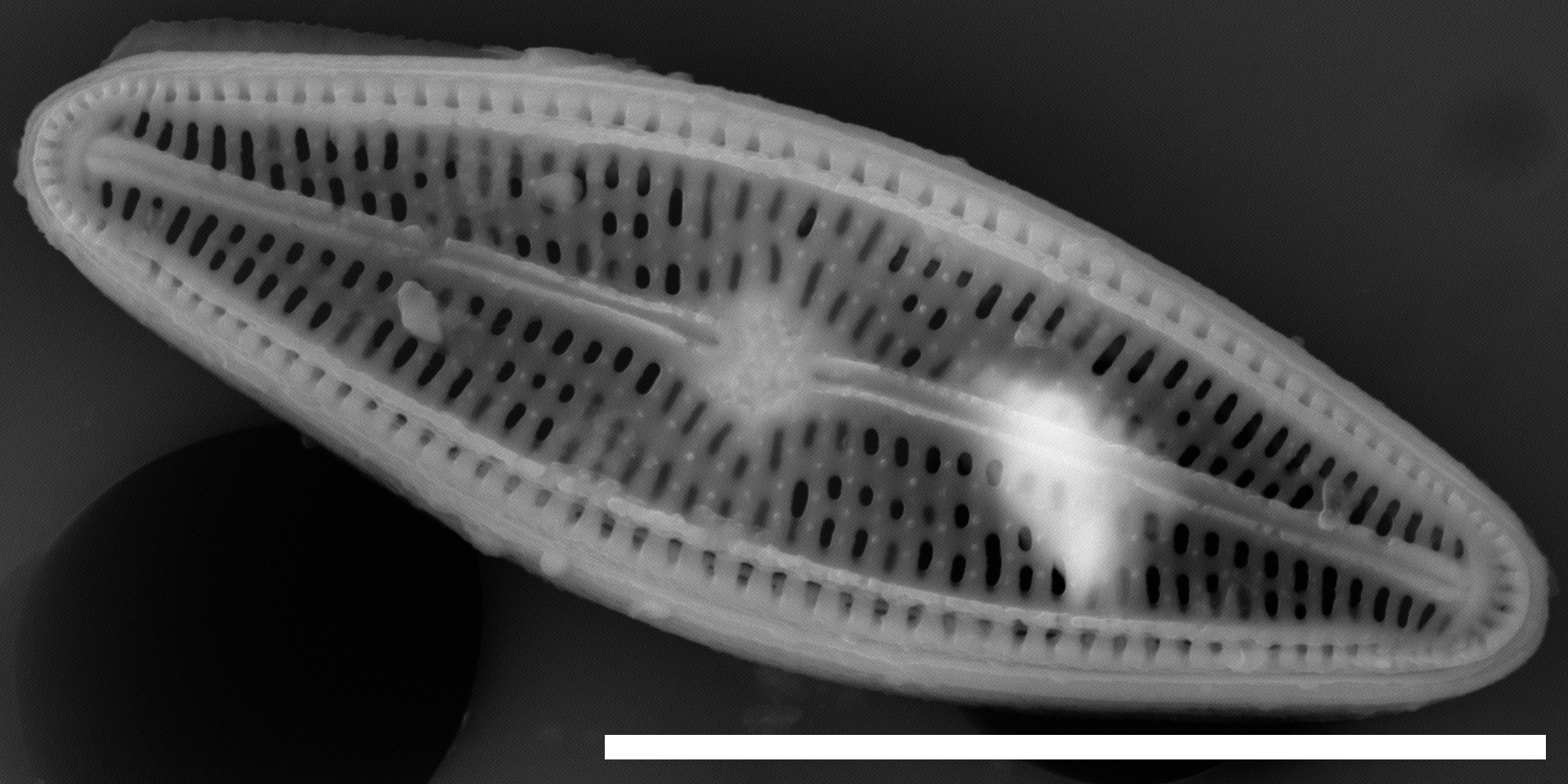 Brachysira sp 1 SEM3 INSTAAR 17658