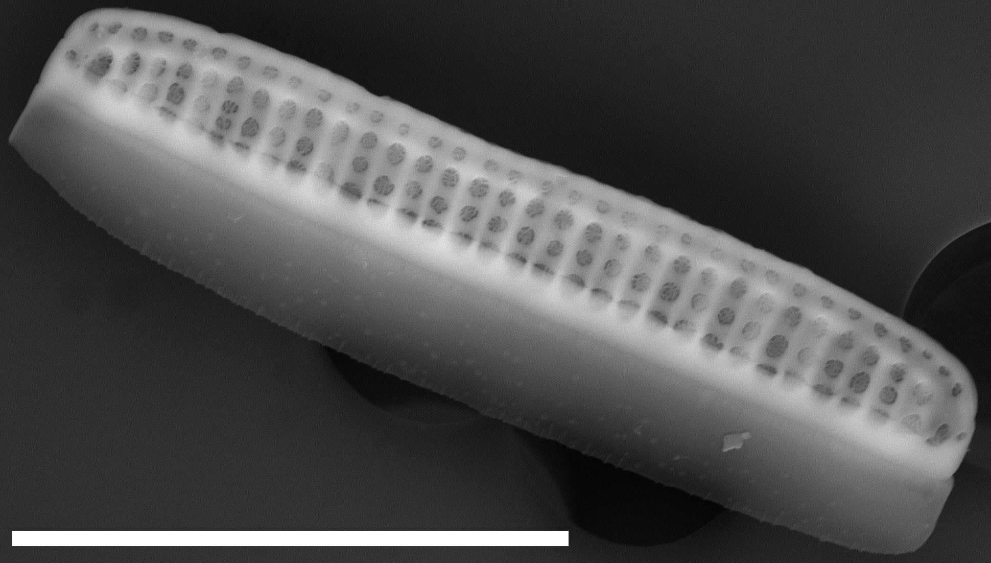 Denticula tenuis SEM1