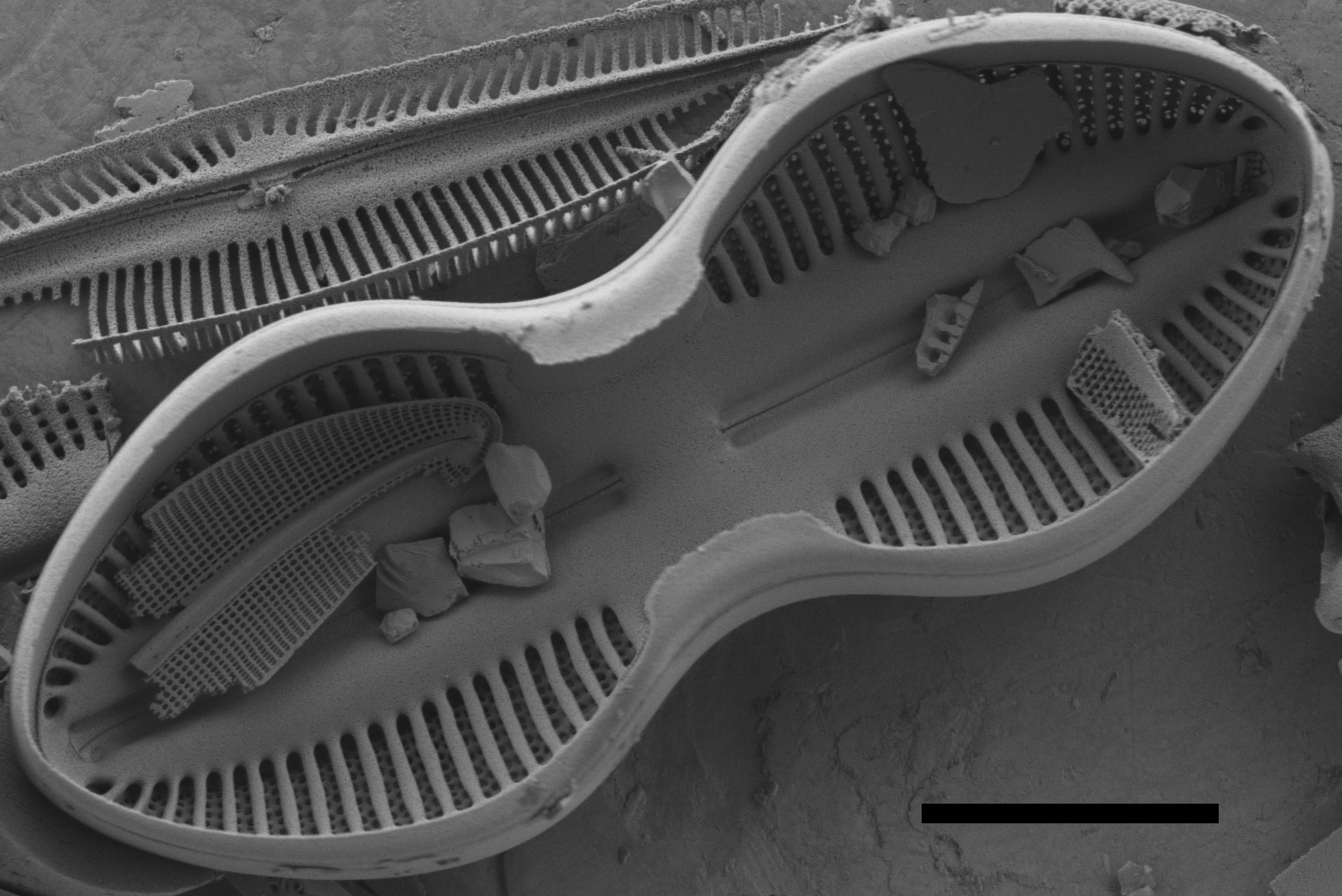Diploneis interrupta SEM2