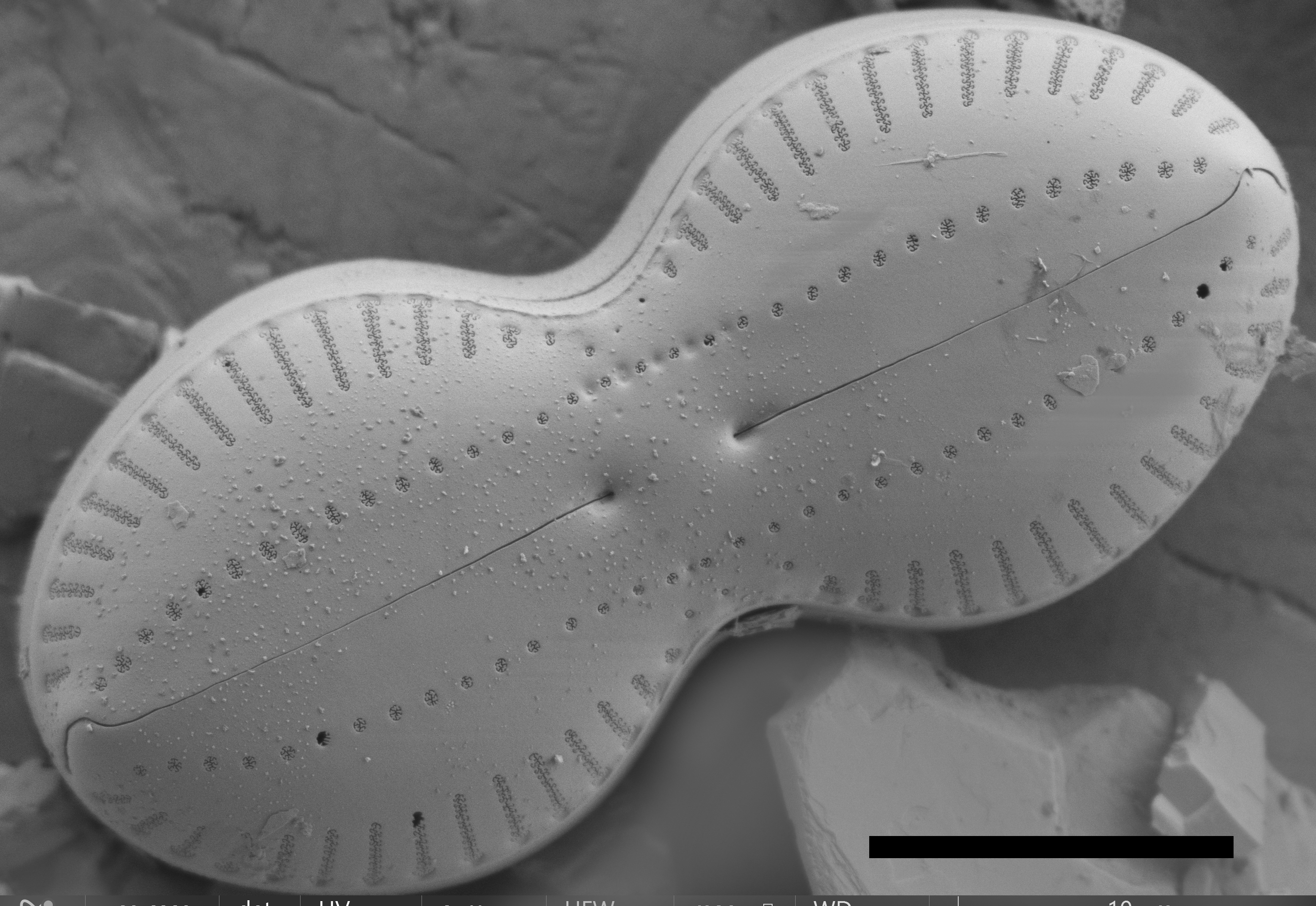 Diploneis interrupta ext SEM1