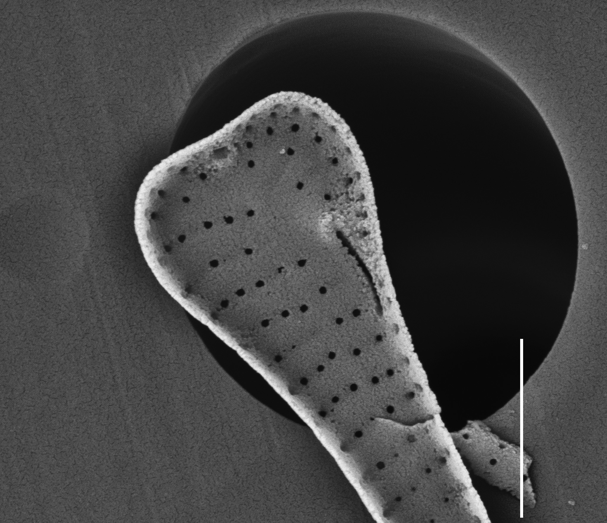 Eunotia Aasuminensis Sem Me 10011Unfiltered 041918 Mix 008