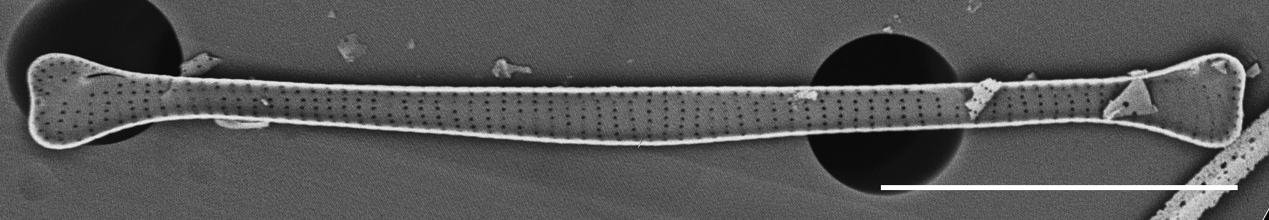 Eunotia Zasuminensis Sem Me 10011Unfiltered 041918 Mix 007