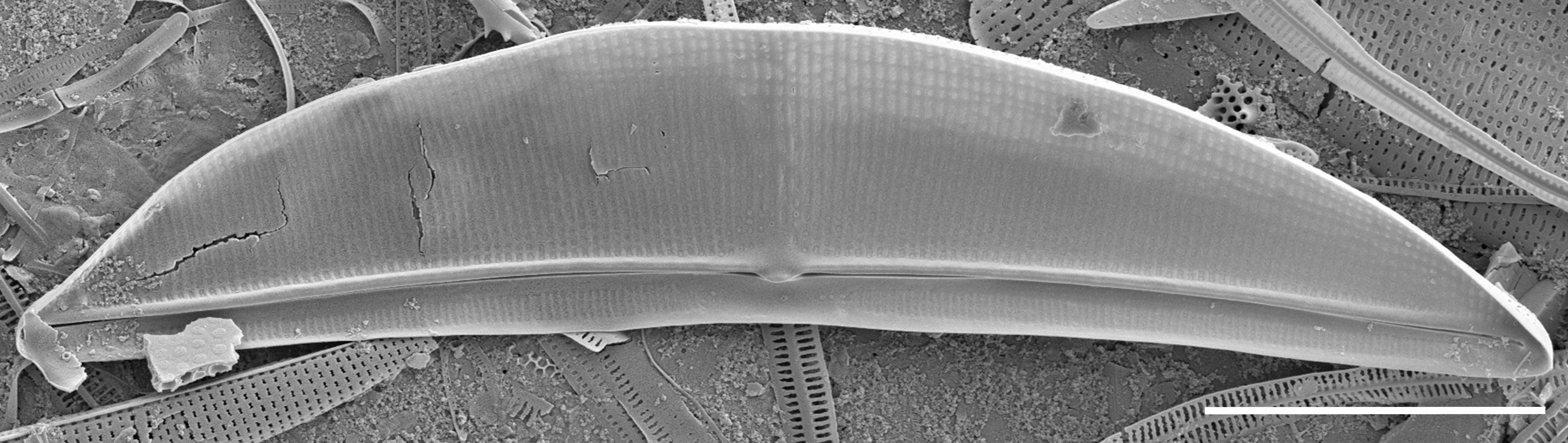 Halamphora baleenicola SEM2