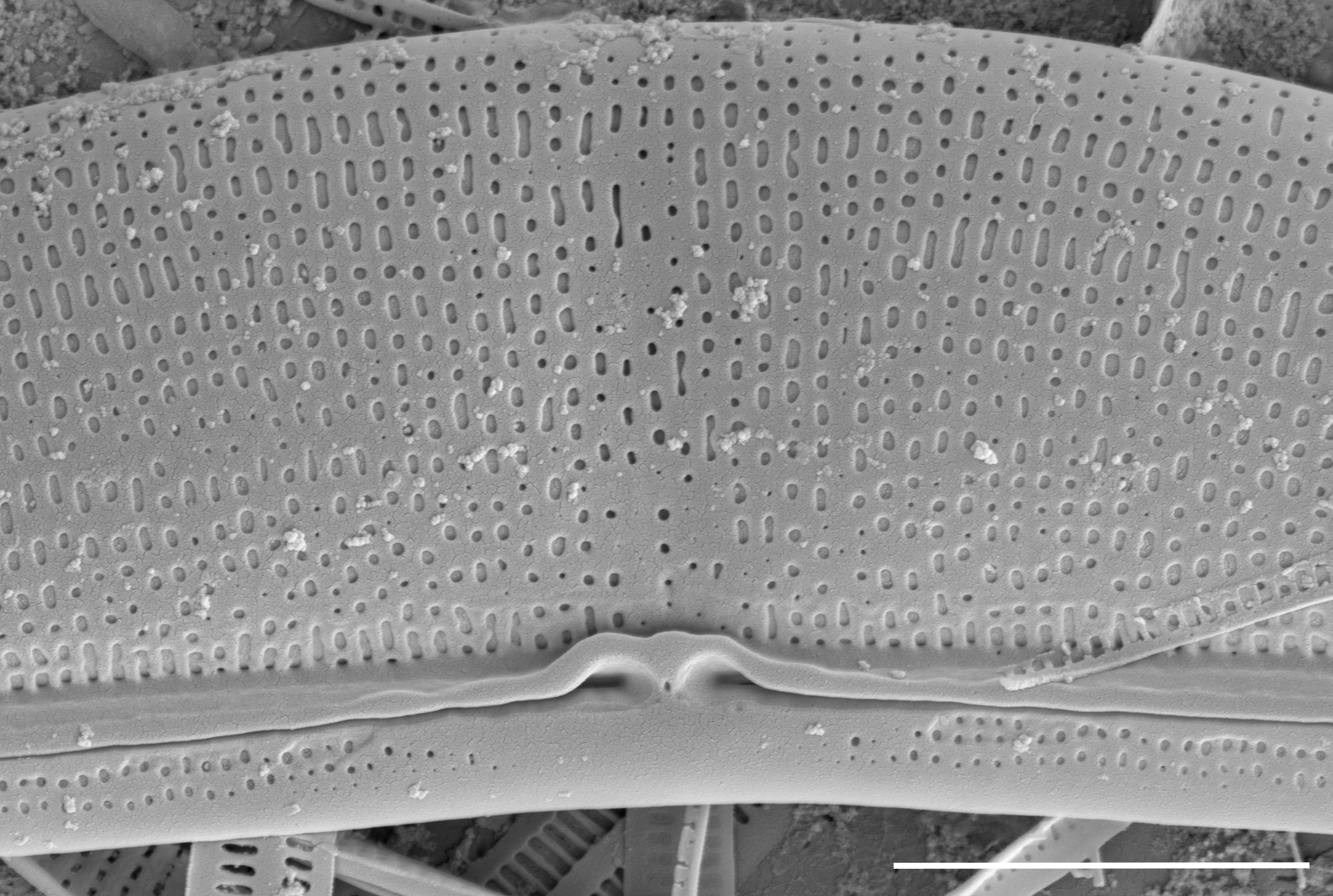 Halamphora baleenicola SEM3