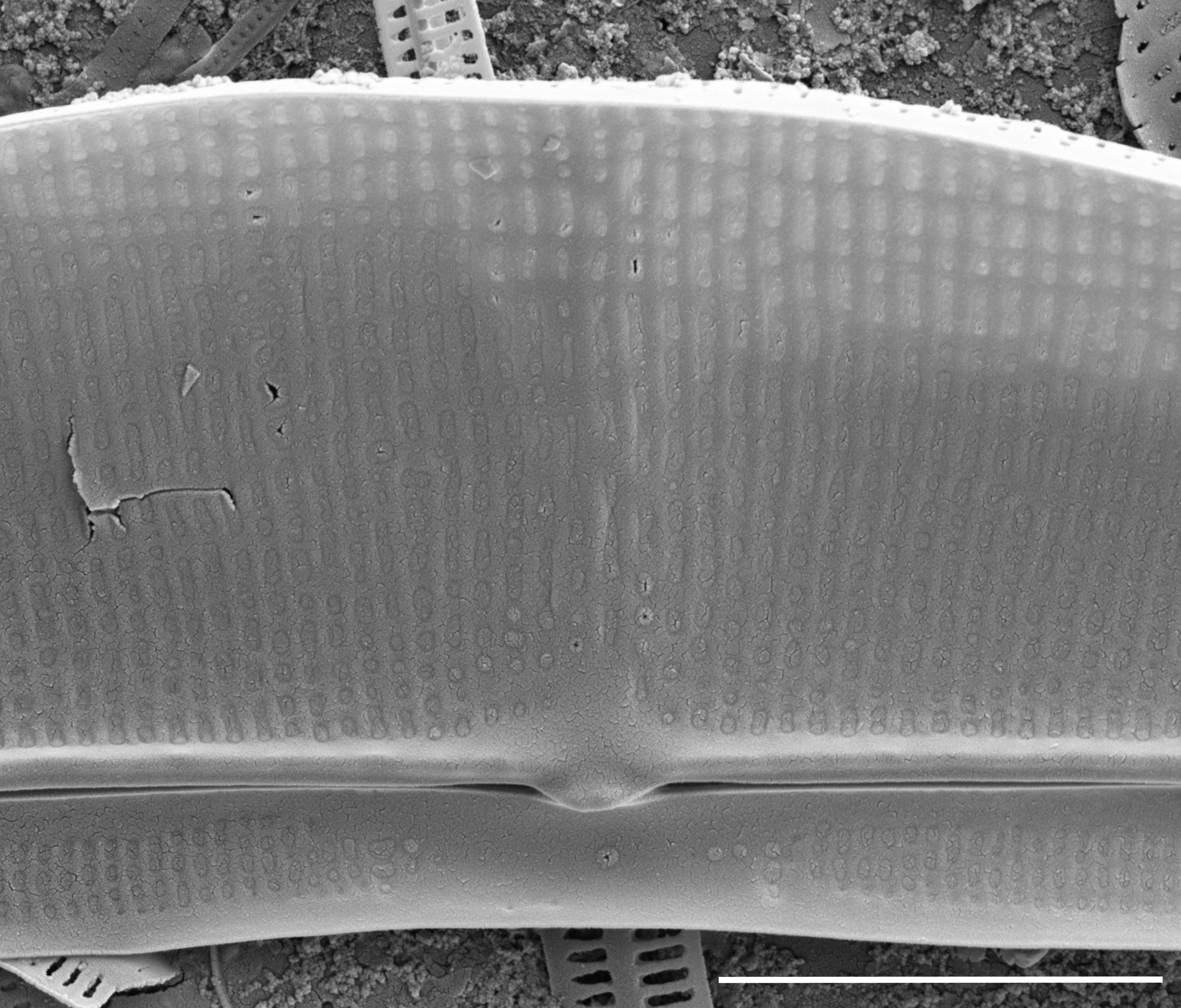 Halamphora baleenicola SEM5