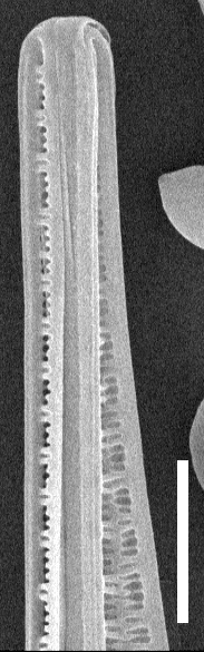 Idelicatissimaapex SEM