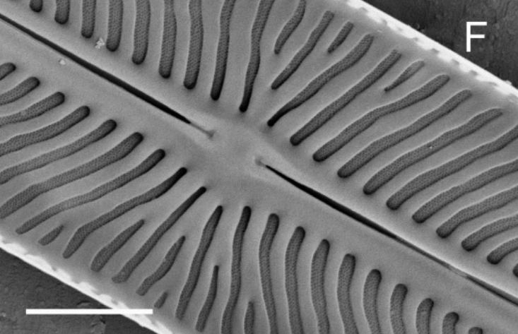Kobayasiella tursujuqensis SEM3