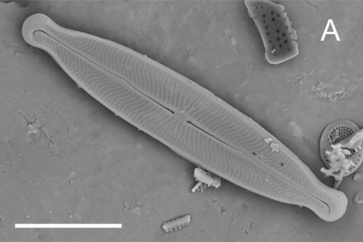Kobayasiella tursujuqensis SEM1