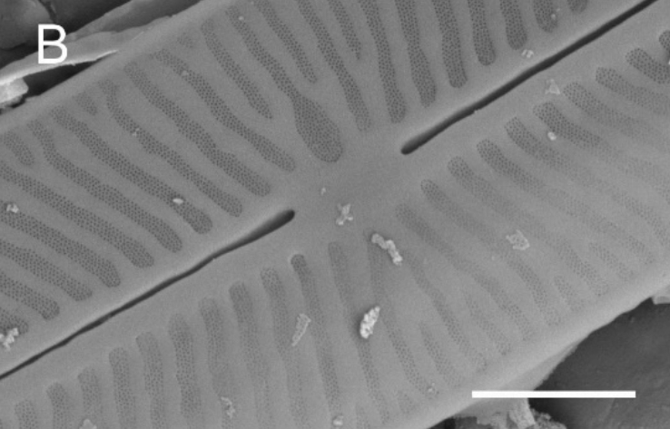 Kobayasiella tursujuqensis SEM2