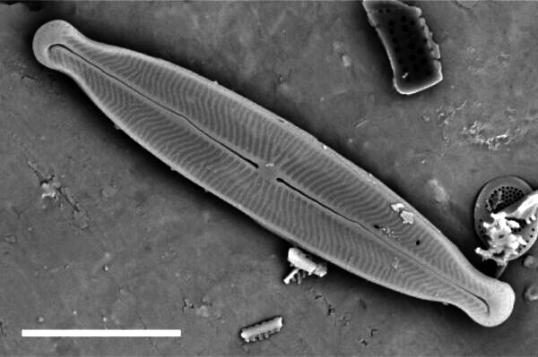 Kobaysiella tursujuqensis SEM1