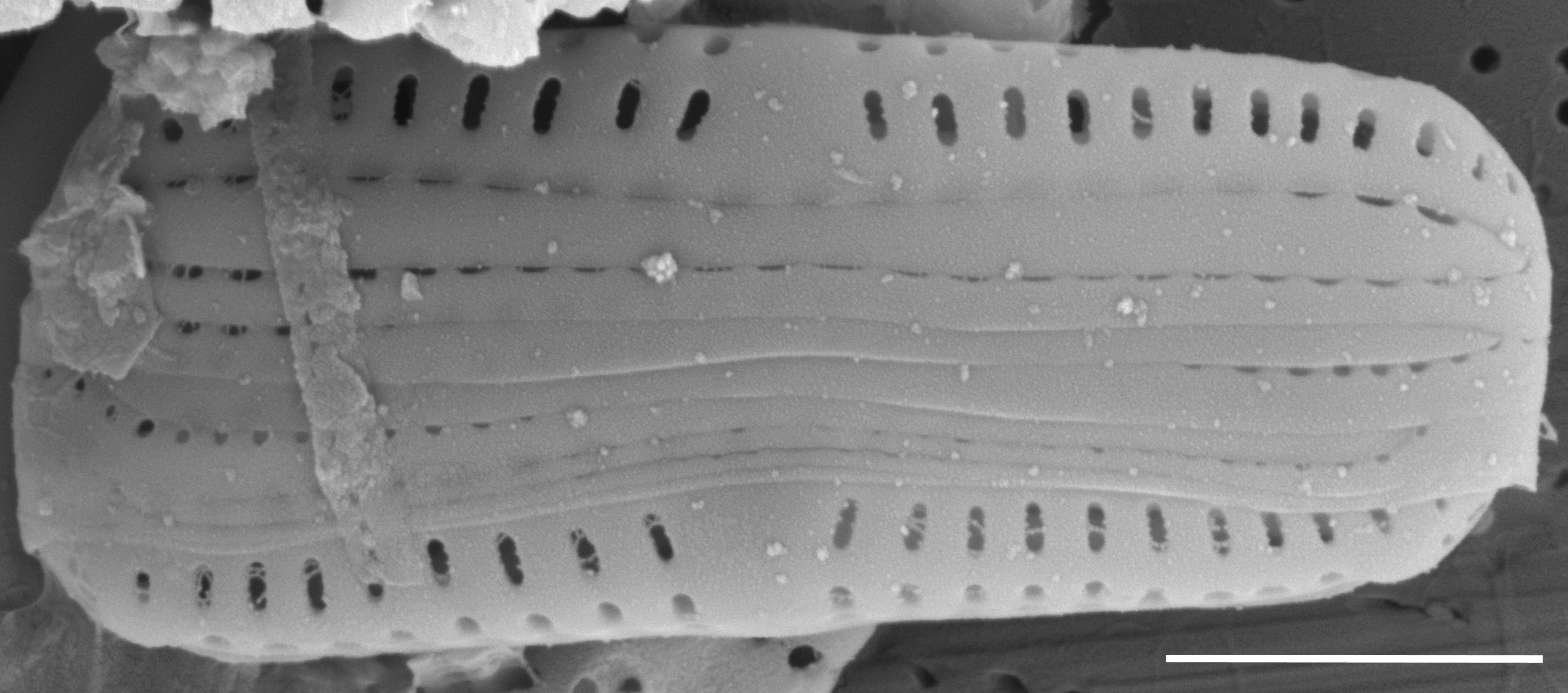 Medlinella amphoroidea SEM1