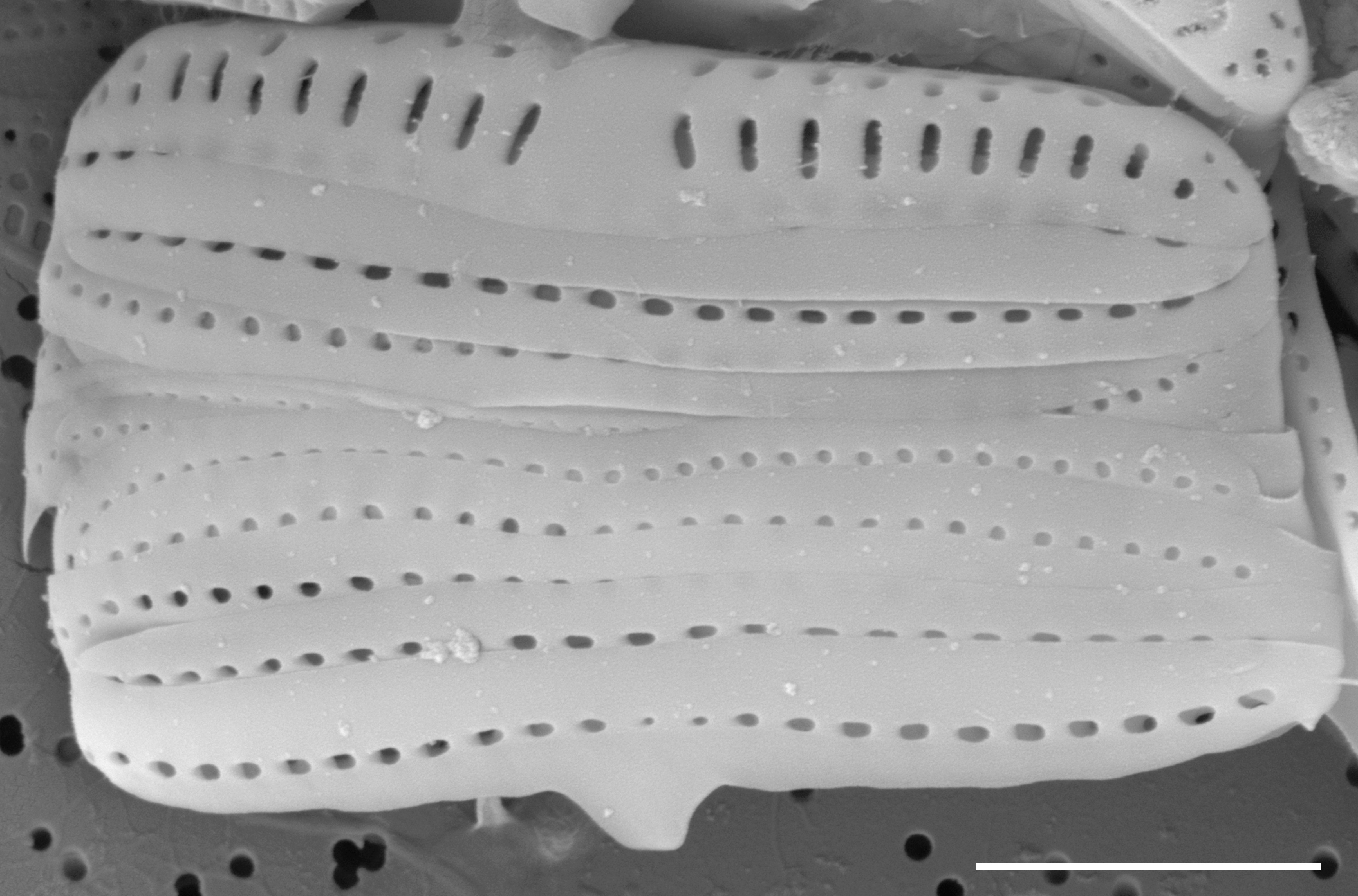 Medlinella amphoroidea SEM2
