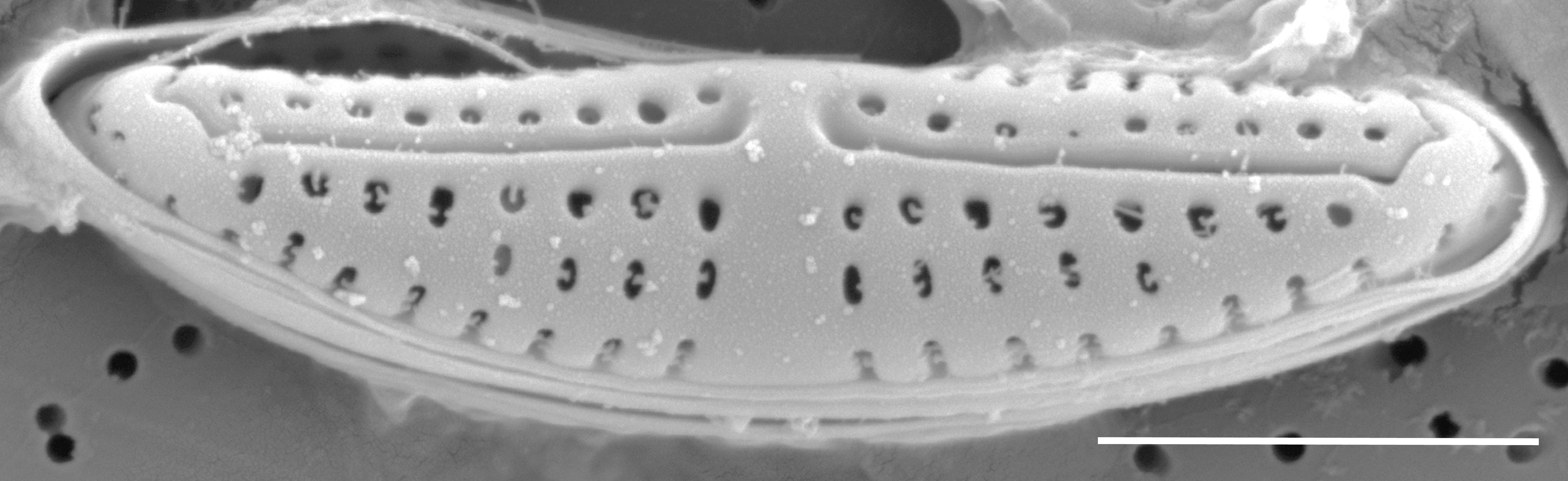 Medlinella amphoroidea SEM3