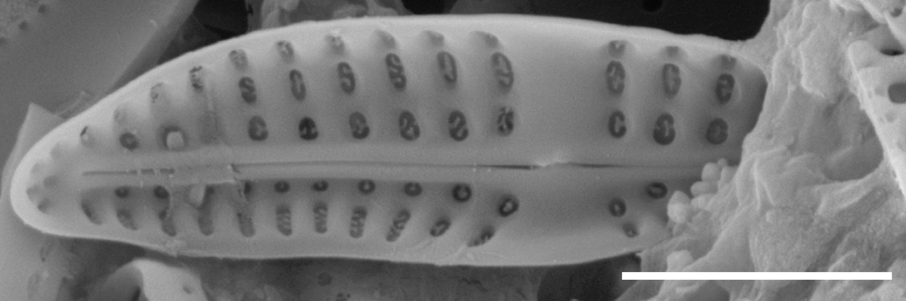 Medlinella amphoroidea SEM4
