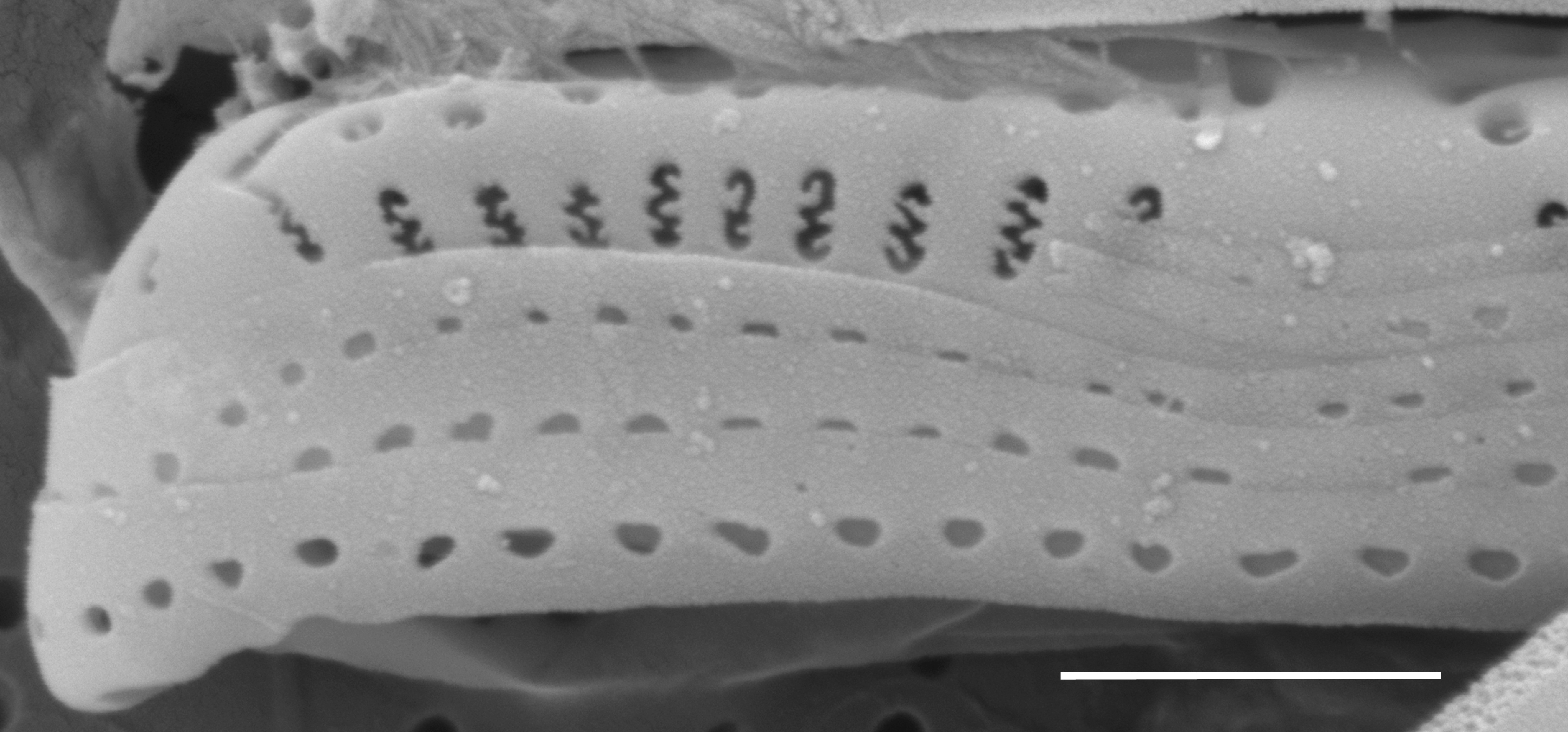 Medlinella amphoroidea SEM5