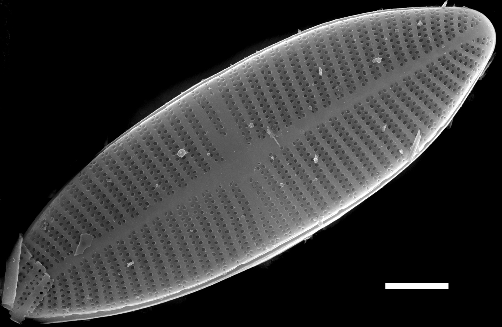 Lemnicola hungarica SEM2