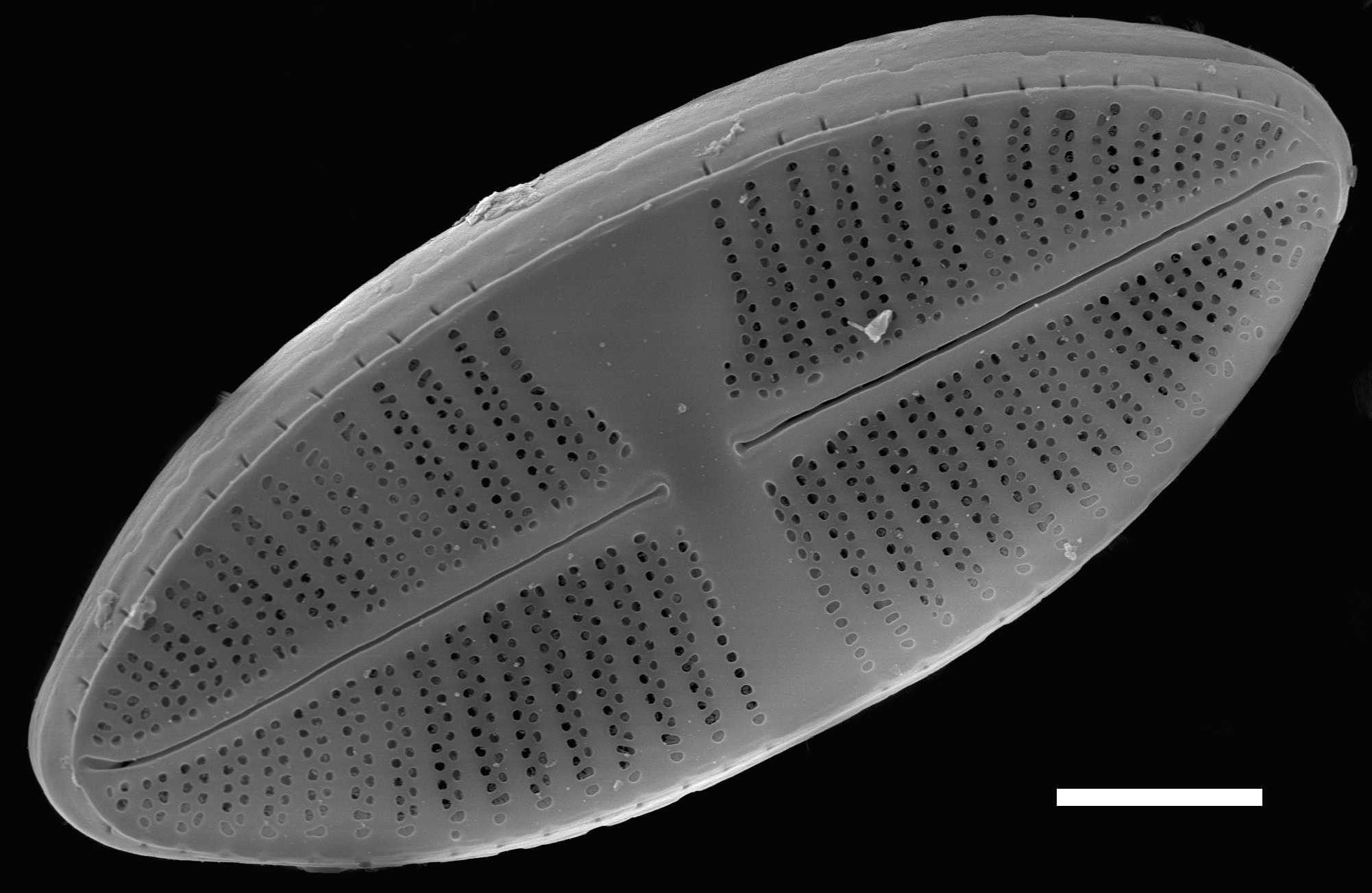 Lemnicola hungarica SEM3