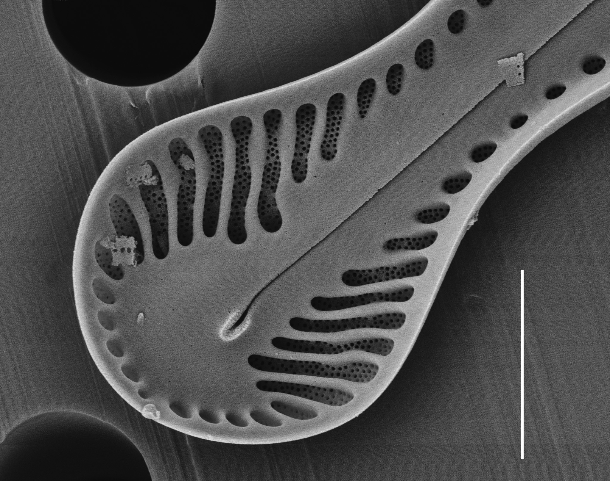 Pinnularia formica SEM1