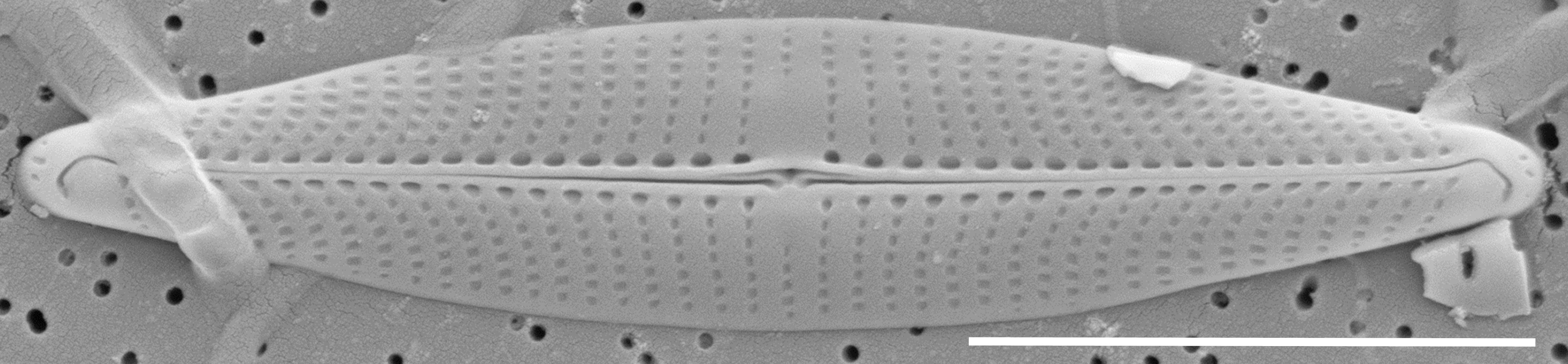 Proschkinia vergostriata SEM1