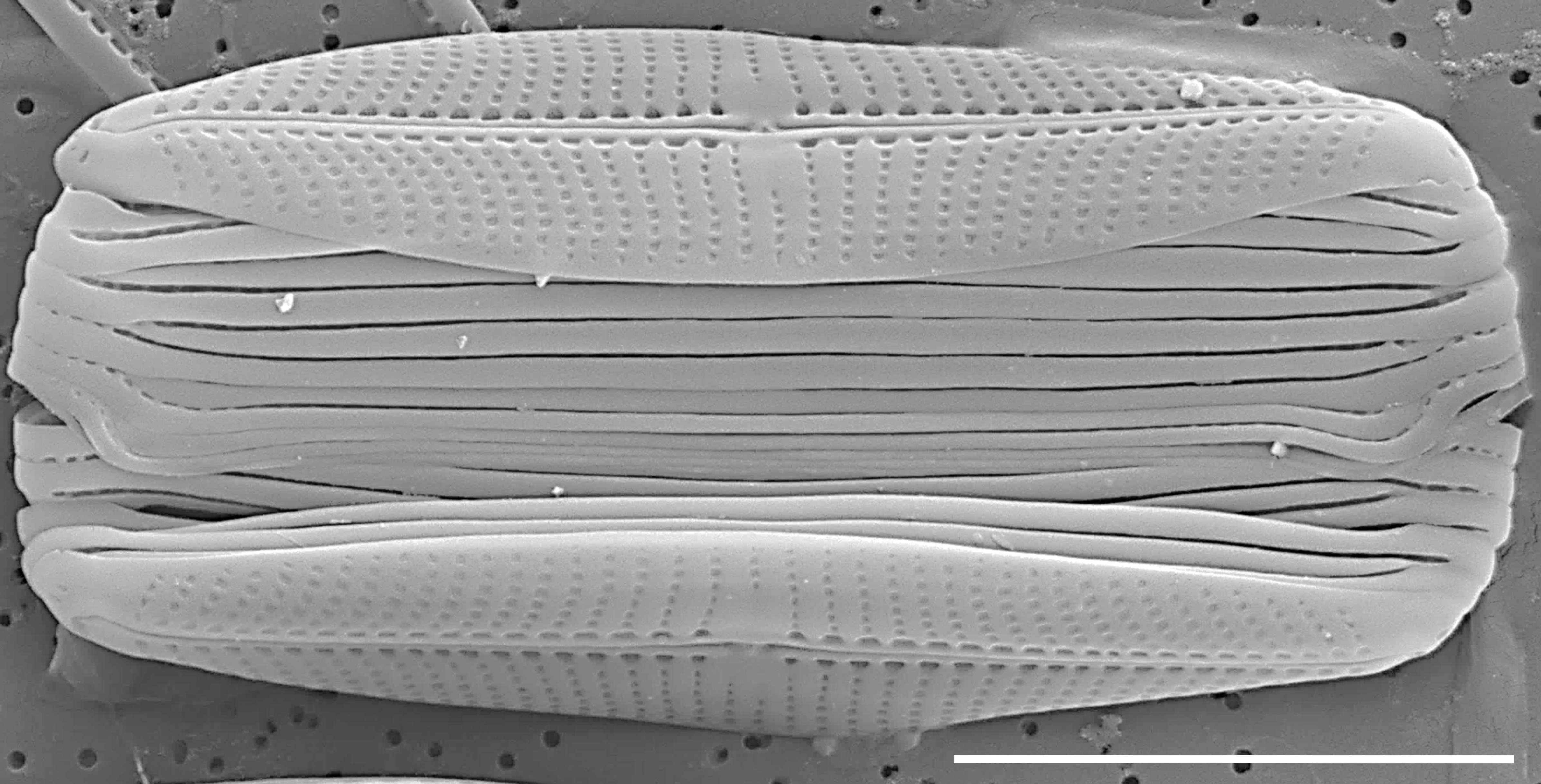 Proschkinia vergostriata SEM2