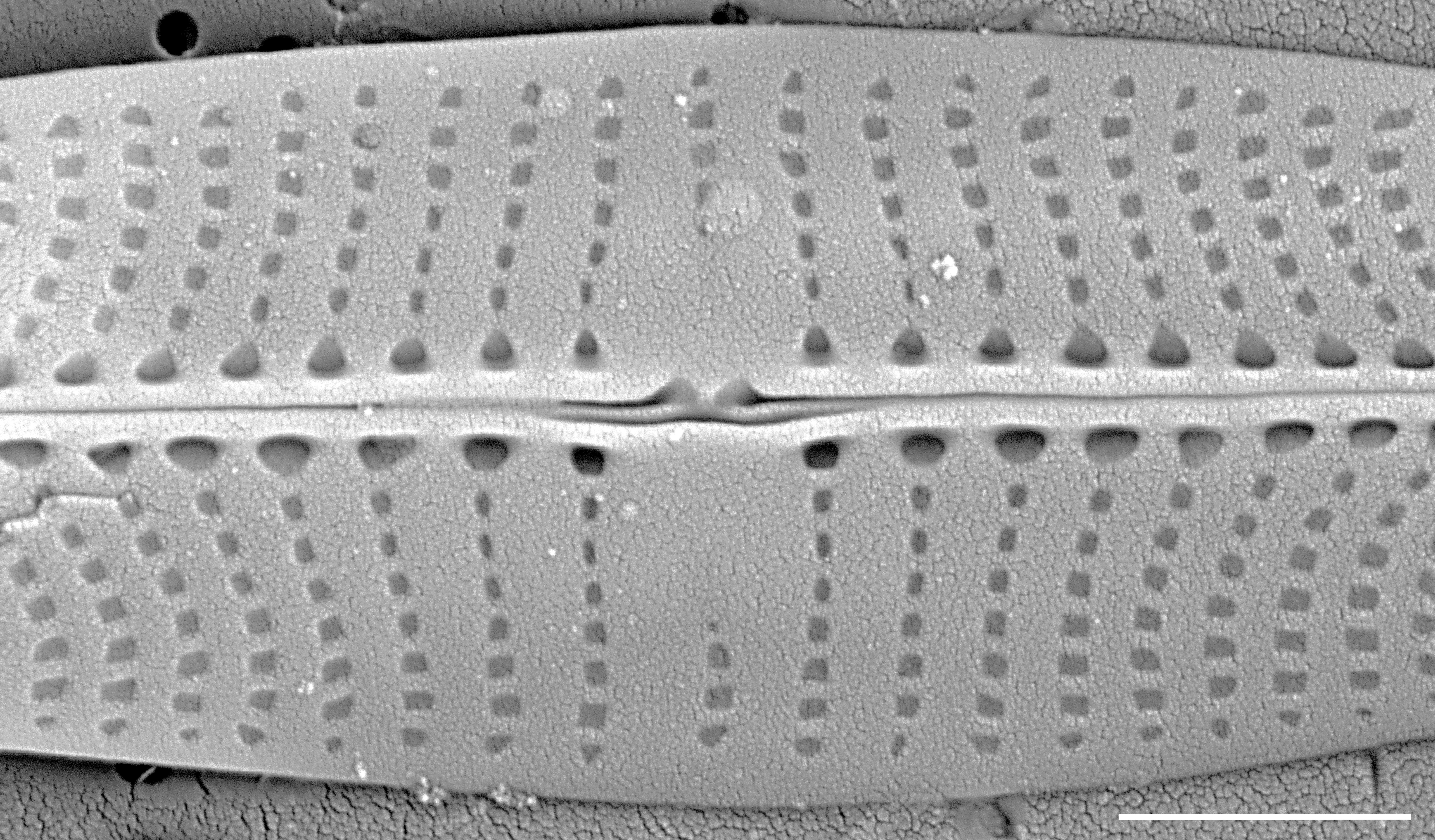 Proschkinia vergostriata SEM4