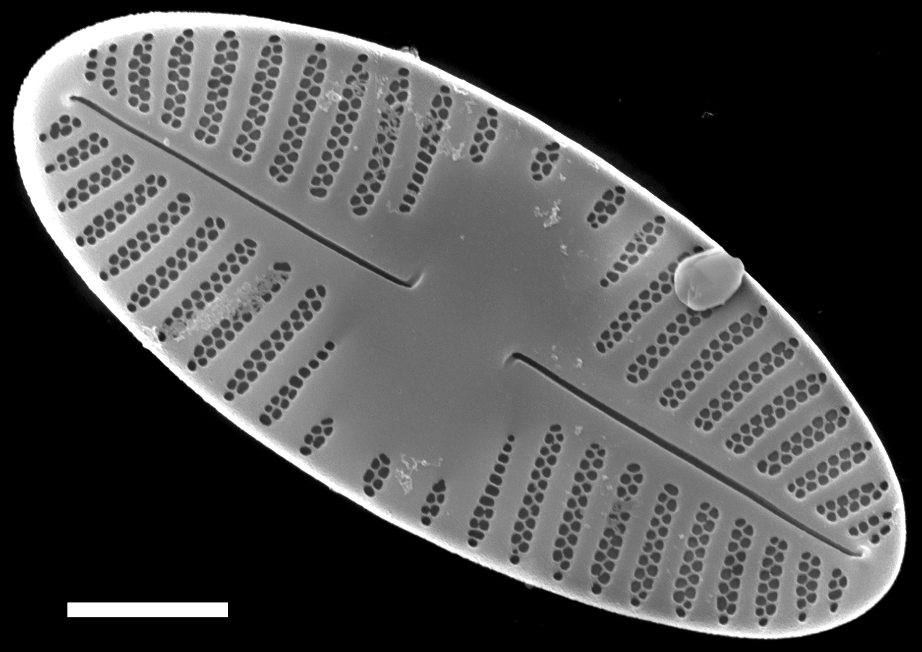 Platessa hustedtii SEM2