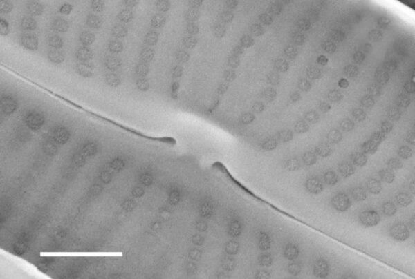 Sellaphora vincentiana SEM2