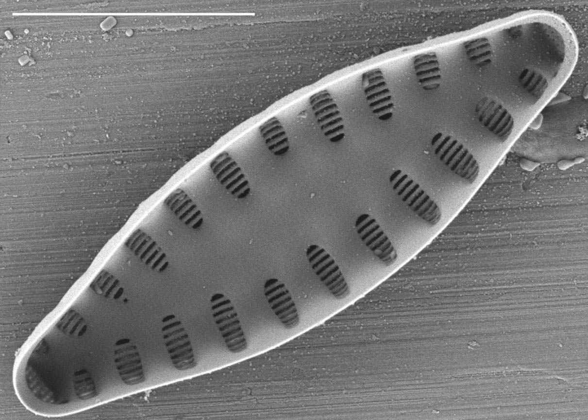 Staurosirella leptostauron var dubia SEM1