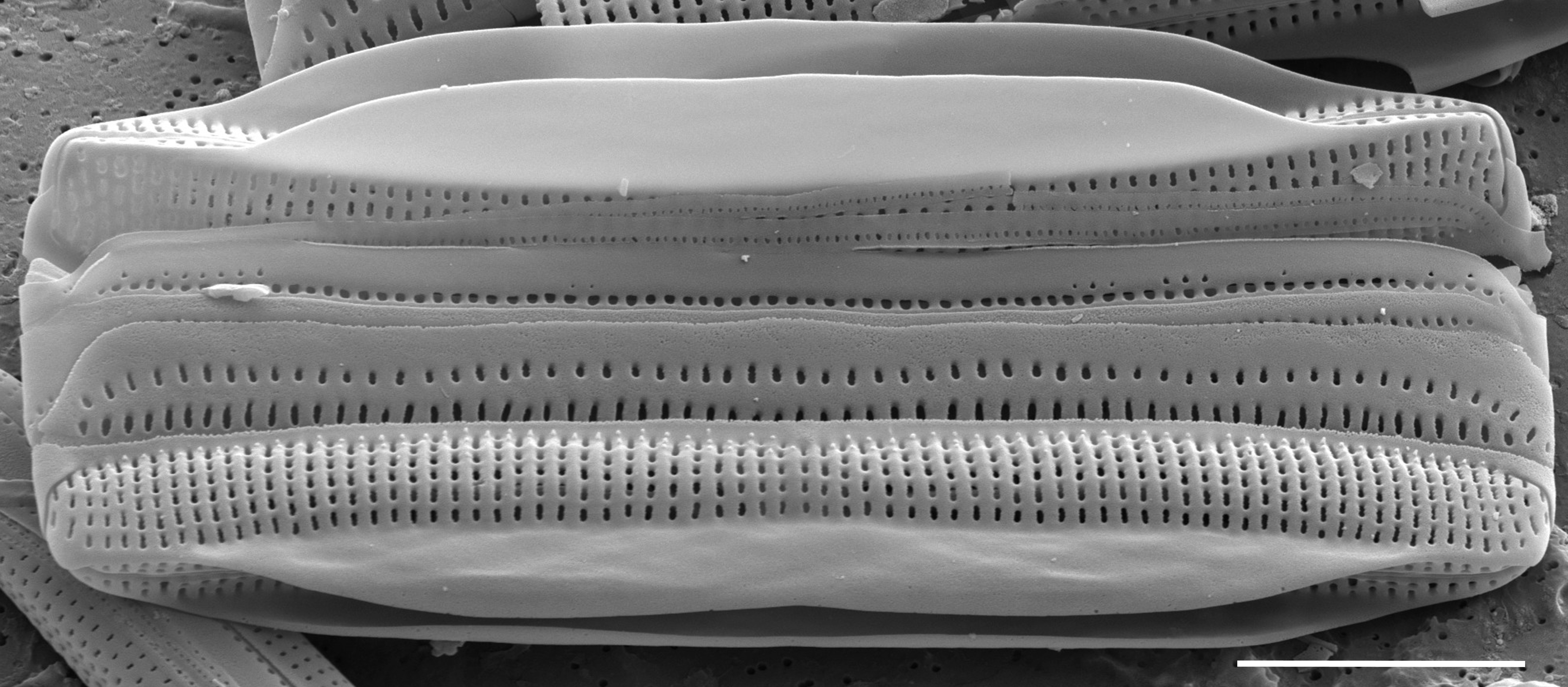 Tursiocola alata SEM1