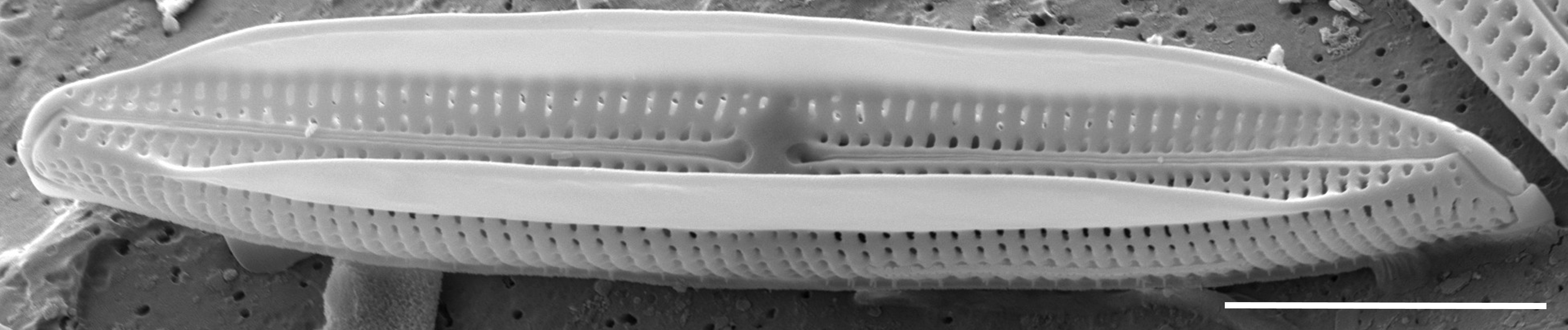 Tursiocola alata SEM2