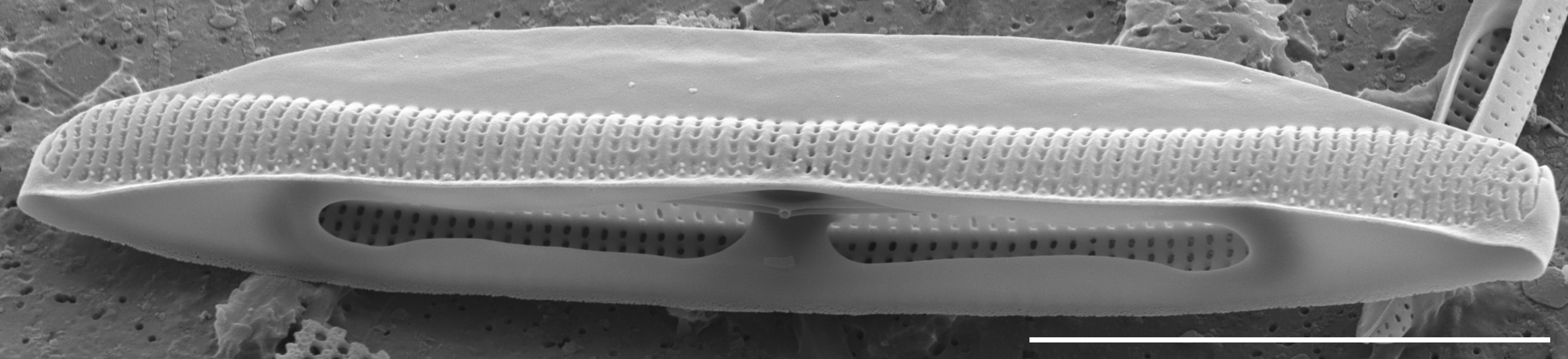 Tursiocola alata SEM4