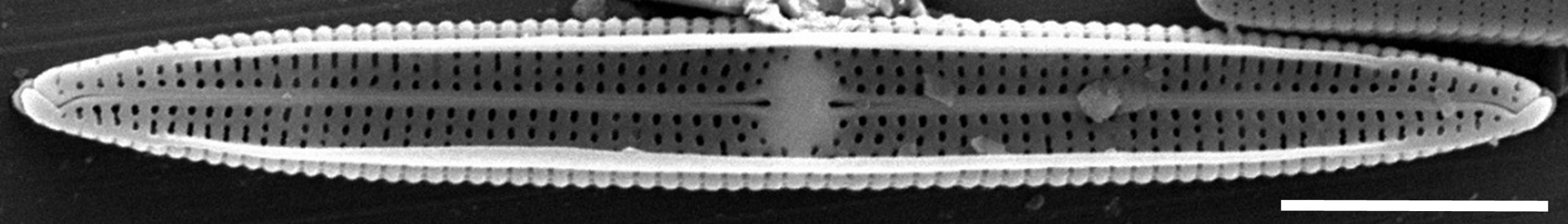 Tursiocola alata SEM5