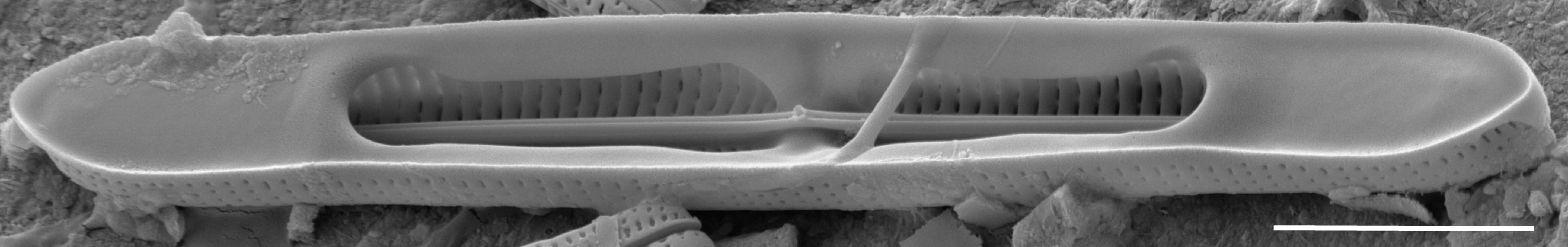 Tursiocola bondei SEM3