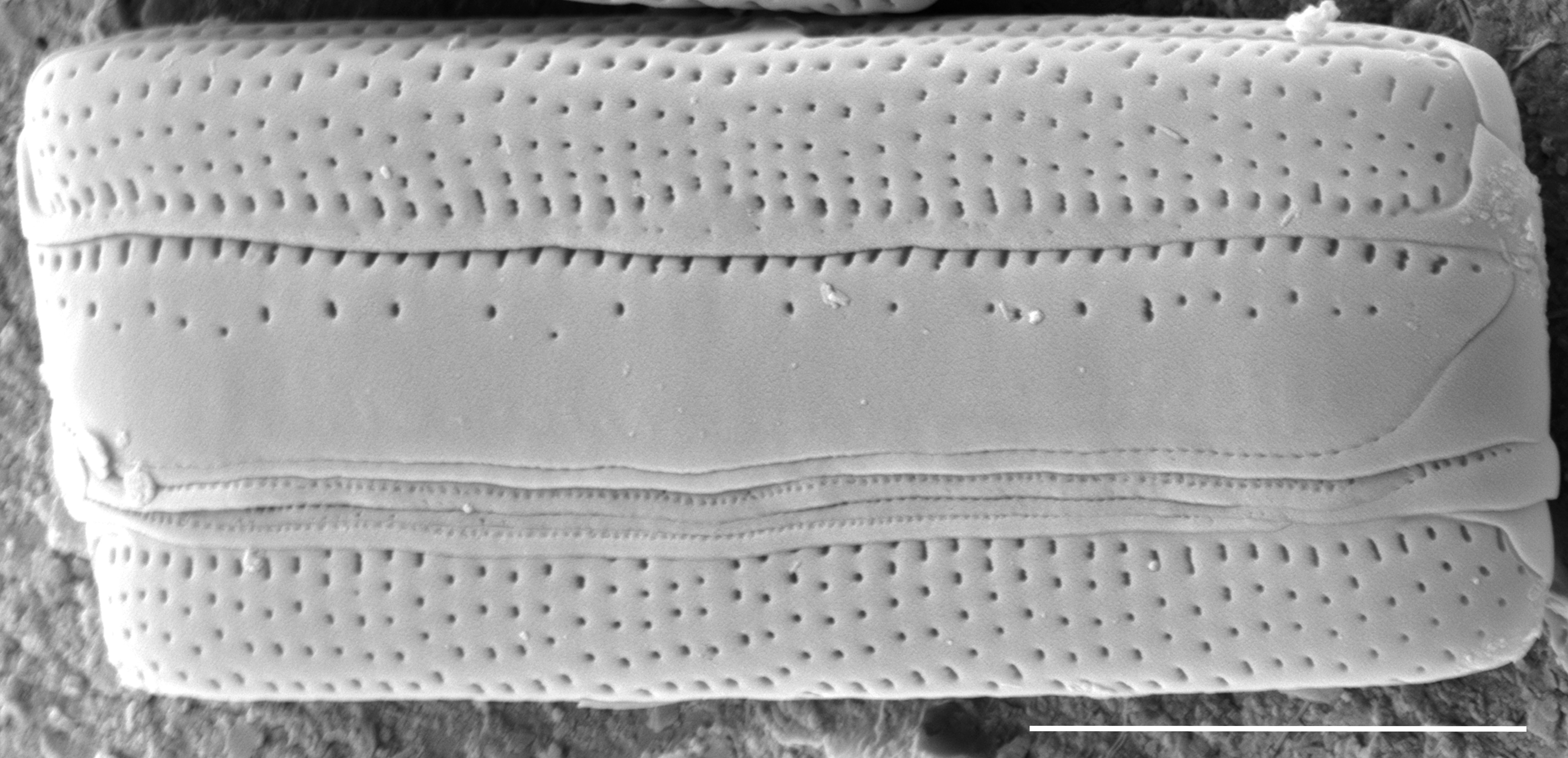 Tursiocola bondei SEM4